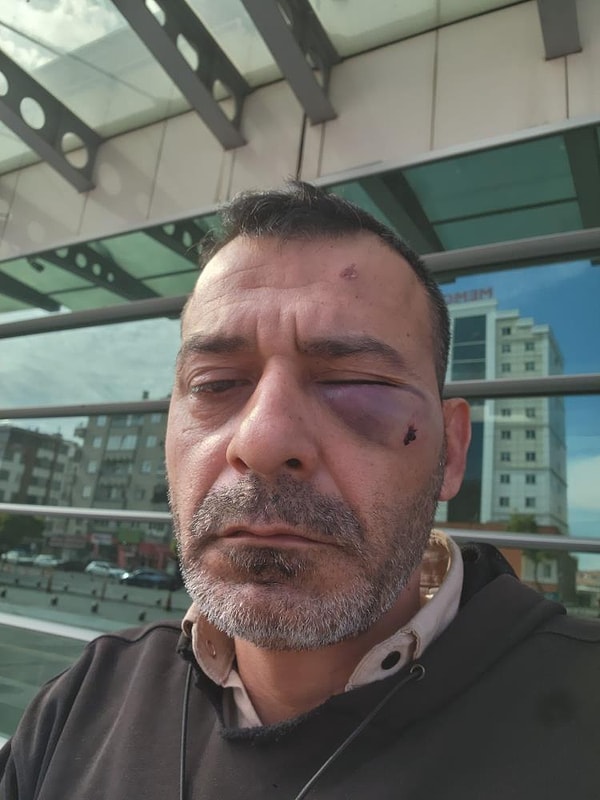 Sosyal medya fenomeni Adem Ocaktan, kardeşi ve oğluyla beraber boşanma aşamasındaki eşi ve ailesi tarafından darbedildi.