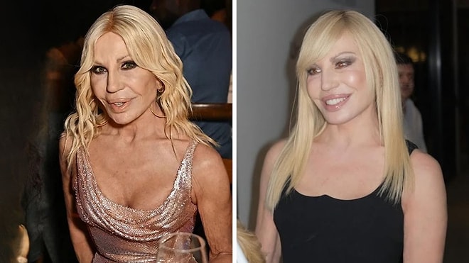 After Dissolving Fillers, 70-Year-Old Donatella Versace’s New Look Stuns