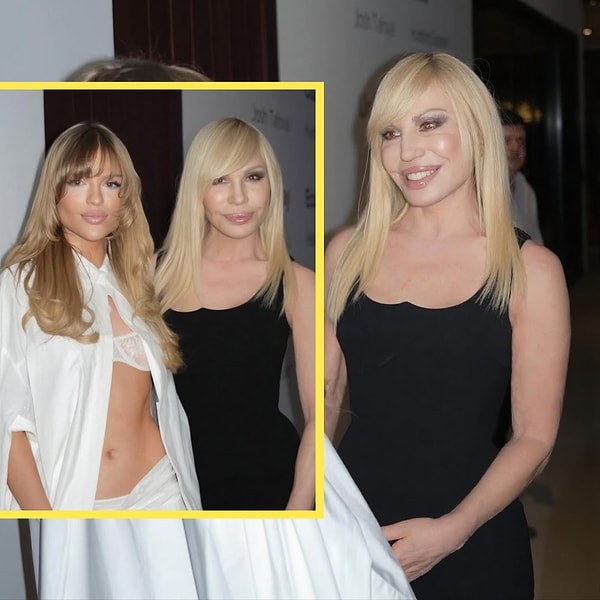 A few months ago, there were claims that Donatella had melted down some of her fillers, reducing their volume and giving her face a somewhat "softer" shape.