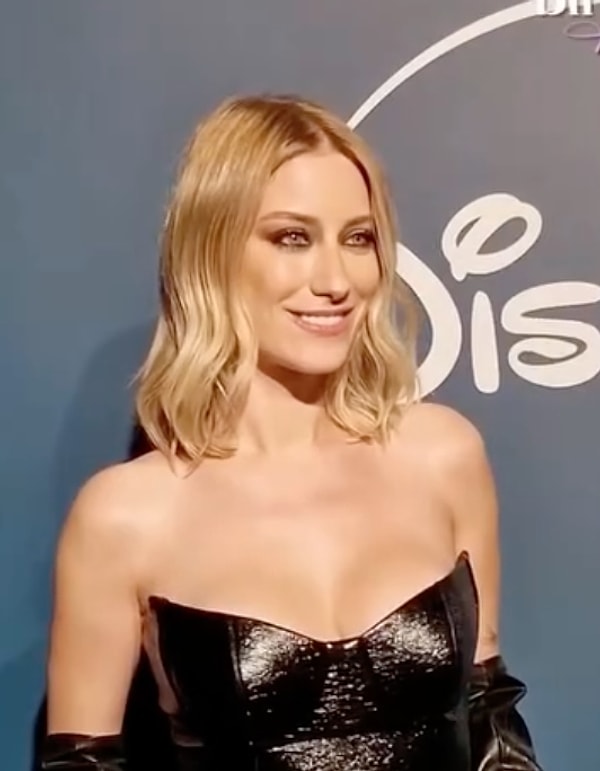 Son dönemde verdiği kilolar, sarıya dönen saçları ve yüzündeki değişikliklerle estetik yorumlarını beraberinde getiriyordu.