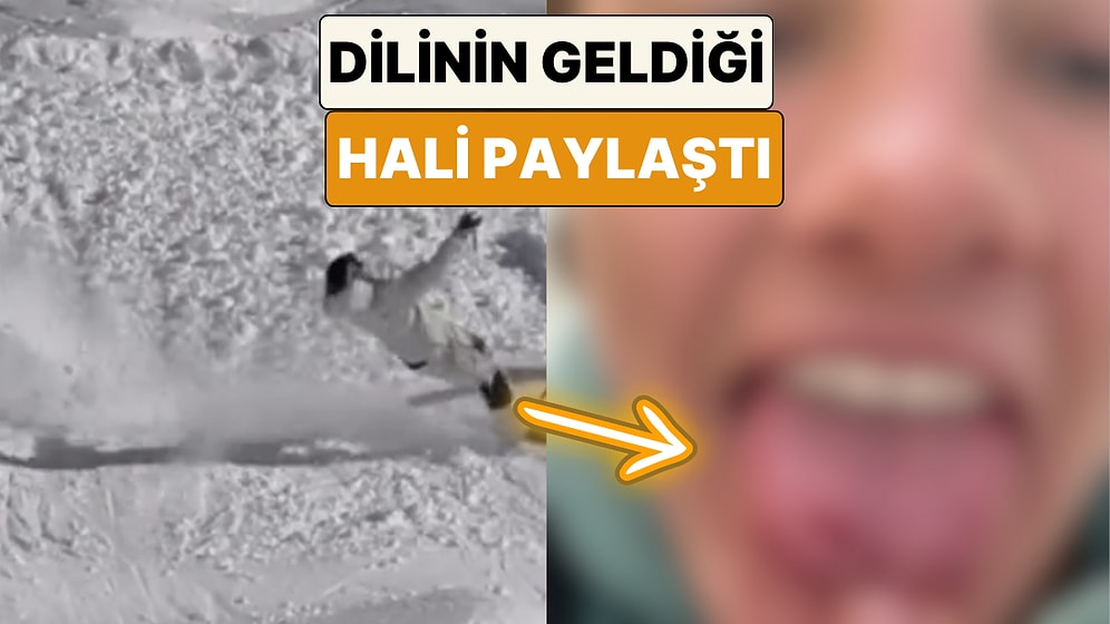 Kayak Yaparken Kaza Geçiren Bir Sporcu Ağızlık Takmadığı İçin Dilinin Geldiği Hali Paylaştı