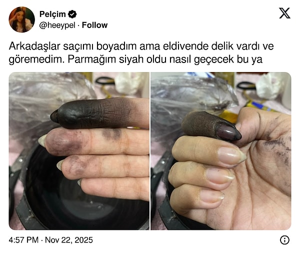 Dibi gelmiş.