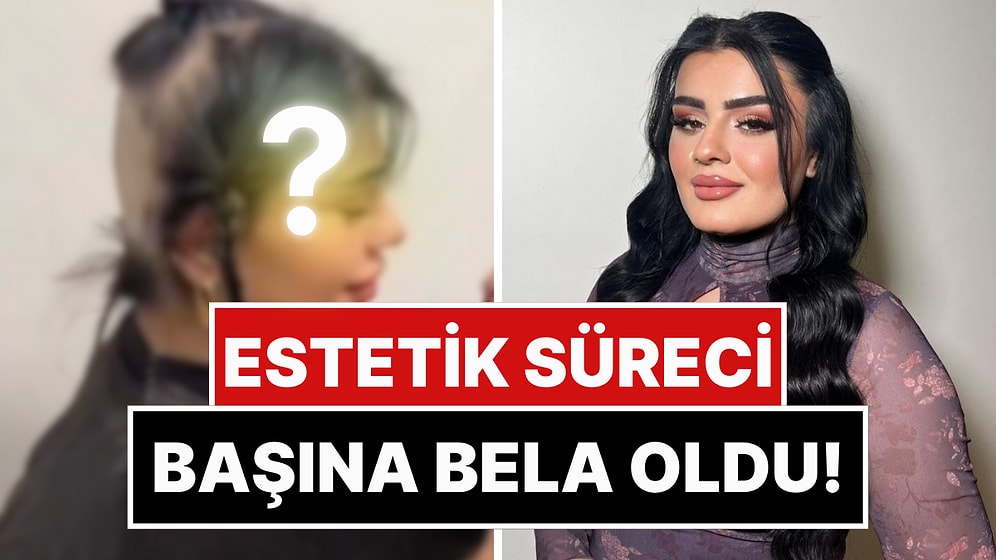 Estetik Sürecinde İçtiği İlaçlar Yüzünden Saçları Dökülen Hülya Mizgin, Son Halini Paylaştı!