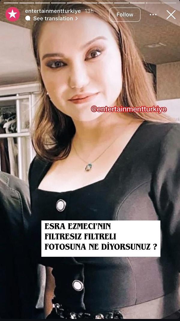 Esra Ezmeci, who consistently denies allegations of having undergone cosmetic procedures, has recently come under the spotlight due to a photograph that surfaced on social media.