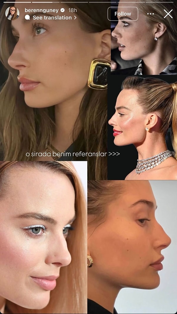 In her latest stories, she shared the profiles that inspired her, lamenting about noses that resemble aesthetics, with a note saying, "A bit of Margot and a bit of Hailey".