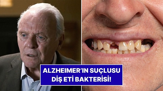 Uzmanlardan Şaşırtan Araştırma: Alzheimer’ın Kaynağı Diş Eti Bakterisi Olabilir!