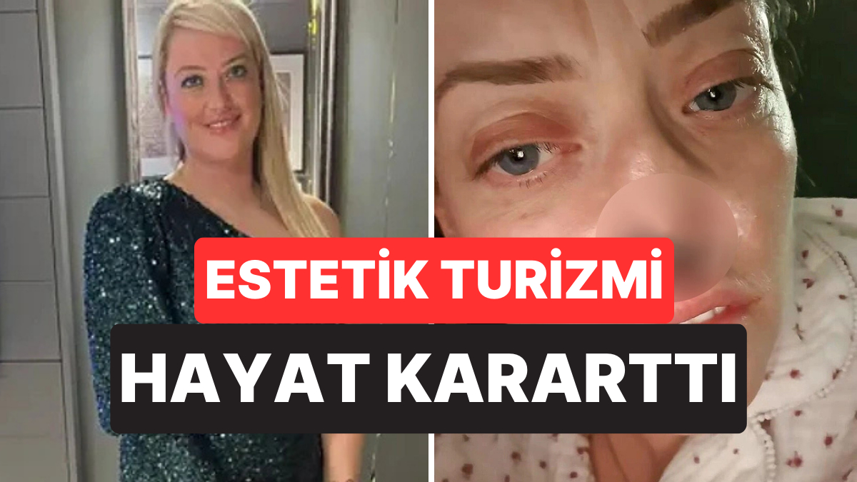 Ucuz Diye Türkiye’de 3 Bin Sterlinlik Diş Yaptırdı, Burnu Çöktü: Kimsenin Konuşmadığı O Risk Gerçek Oldu