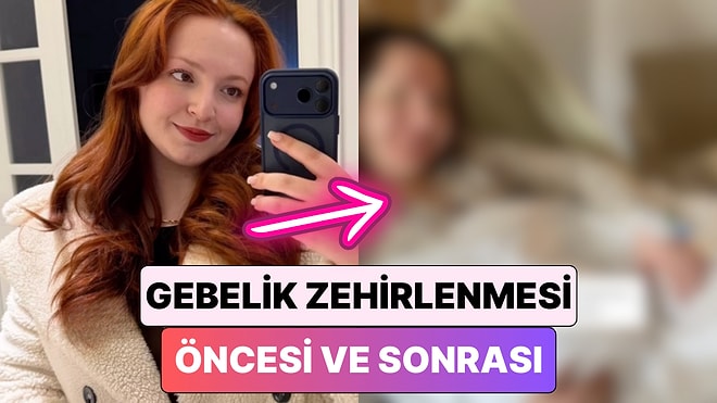 Hamileliği Sırasında "Gebelik Zehirlenmesi" Yaşayan Bir Kadın Yüzünde Meydana Gelen Değişimi Paylaştı