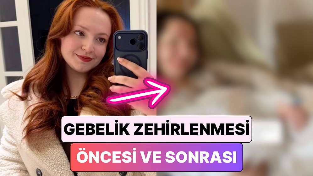 Hamileliği Sırasında "Gebelik Zehirlenmesi" Yaşayan Bir Kadın Yüzünde Meydana Gelen Değişimi Paylaştı