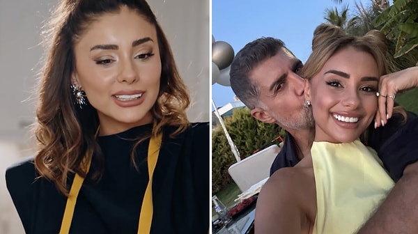 Samar Dadgar, kendisine “estetikten ağzın yamulmuş” şeklinde yorumlar yapanlara sosyal medya hesabından şu sözlerle yanıt verdi: