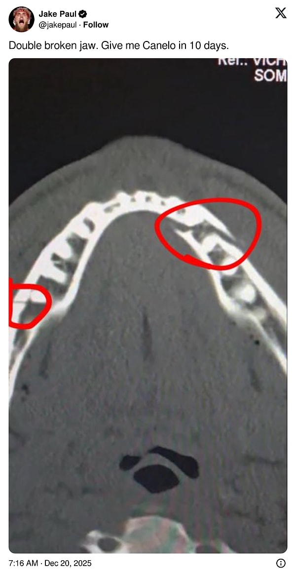 İşte Jake Paul'un gönderisi 👇🏻