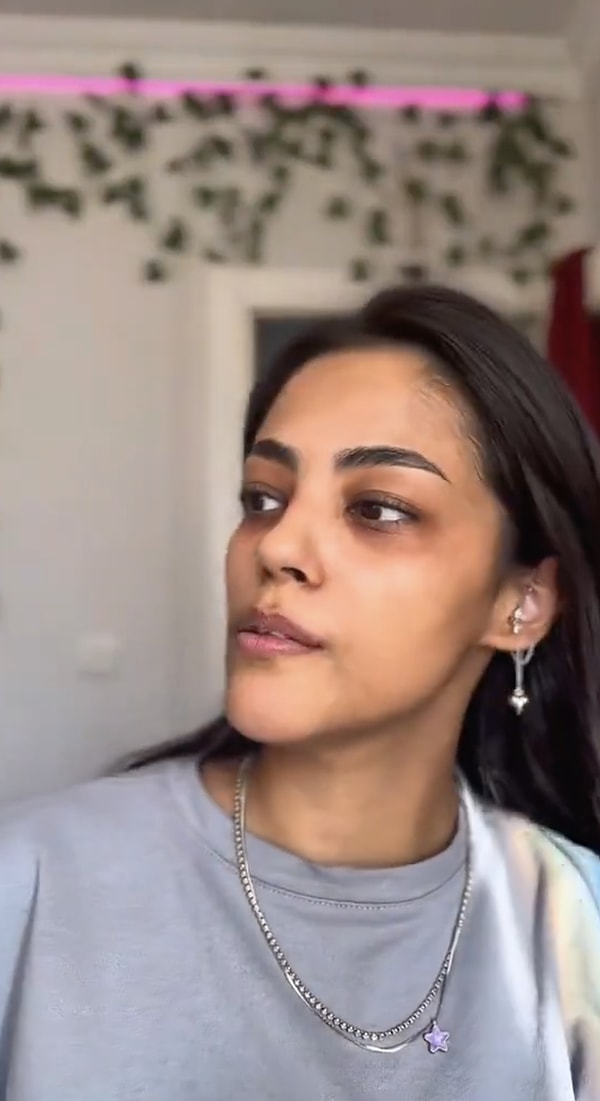 Bir kullanıcı, ten rengi yüzünden nasıl zorbalandığını anlattı.