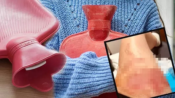 "Her hafta en az 5-6 benzer vaka görüyoruz, şu anda 3 tane yatan hastamız var"