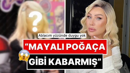 Yaptırmadığı Estetik Kalmayan Seda Sayan'ın Yüzündeki Ekstra Şişlik Göze Fena Battı!