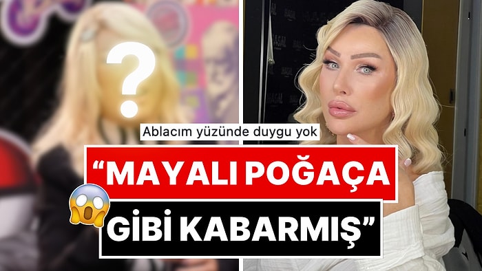 Yaptırmadığı Estetik Kalmayan Seda Sayan'ın Yüzündeki Ekstra Şişlik Göze Fena Battı!