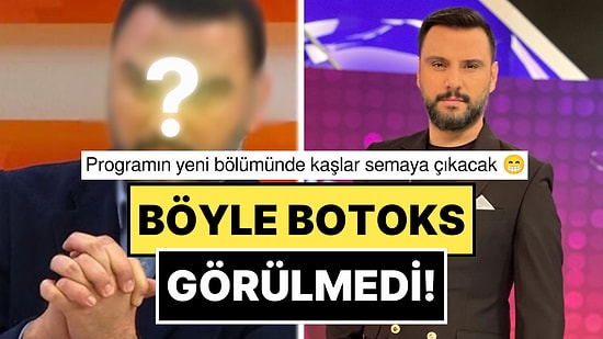 Bu Nasıl Bir Botoks? Alişan'ın Yükselişe Geçen Kaşları ve Son Hali Ağızları Açık Bıraktı!