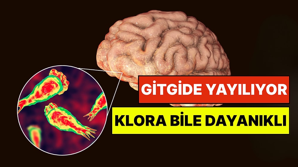 Uzmanlardan Korkutan Beyin Yiyen Amip Uyarısı: "Dünya Genelinde Su Sistemlerine Yayılıyor"