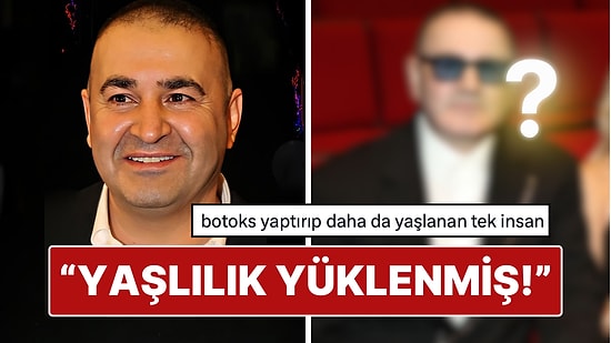 Yüzünün Son Haliyle Dikkat Çeken Şafak Sezer'in Estetik Açıklaması X'te Gündem Oldu!