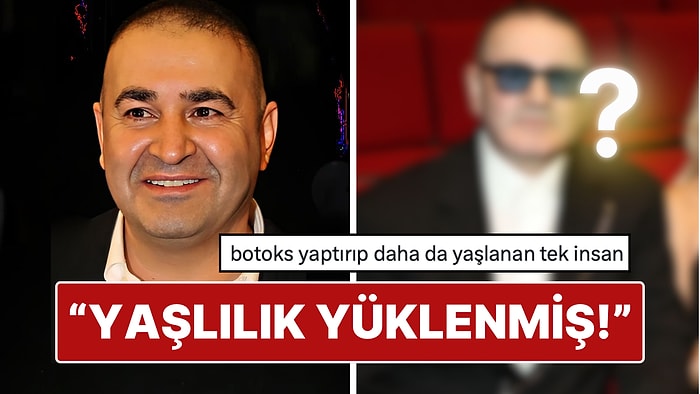 Yüzünün Son Haliyle Dikkat Çeken Şafak Sezer'in Estetik Açıklaması X'te Gündem Oldu!