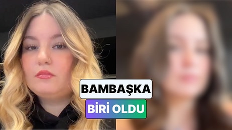 Yaklaşık 30 Kilo Veren Bir Kadın Yüzünde Meydana Gelen Değişimi Paylaştı