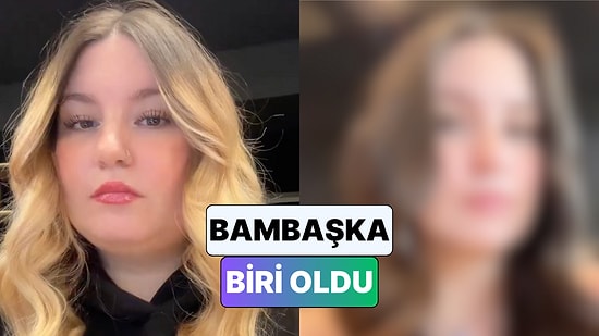 Yaklaşık 30 Kilo Veren Bir Kadın Yüzünde Meydana Gelen Değişimi Paylaştı