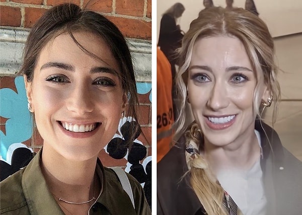 Son dönemde katıldığı davetler, kırmızı halı görünümleri ve verdiği pozlarla yeniden gündeme gelen Hazal Kaya, bu kez oyunculuğuyla değil dişlerindeki değişimle konuşuldu.