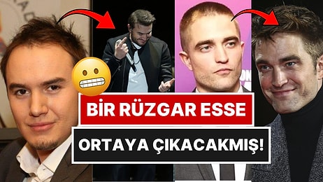 Eski Hallerini Görünce Bi' Miktar Şok Olacağınız Protez Saçlı Ünlüler