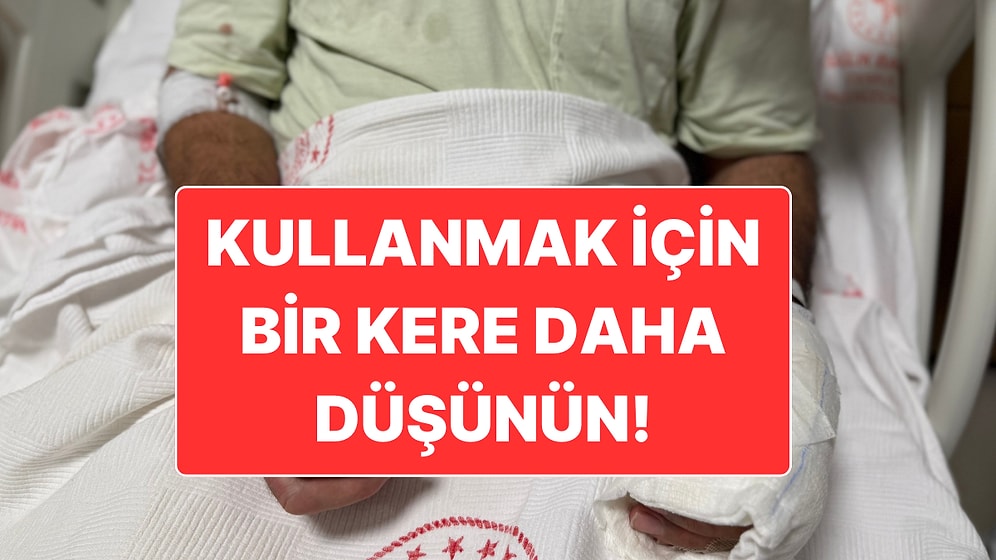 Patlayan Sıcak Su Torbası Nedeniyle Vücudunun Yüzde 30’u Yandı