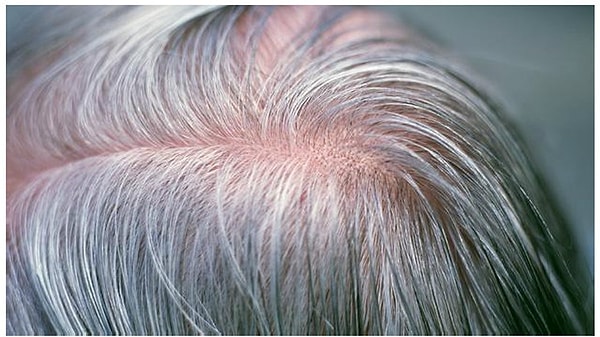 Saçlarda beliren ilk beyaz teller çoğu kişi için küçük ama moral bozan bir detay.