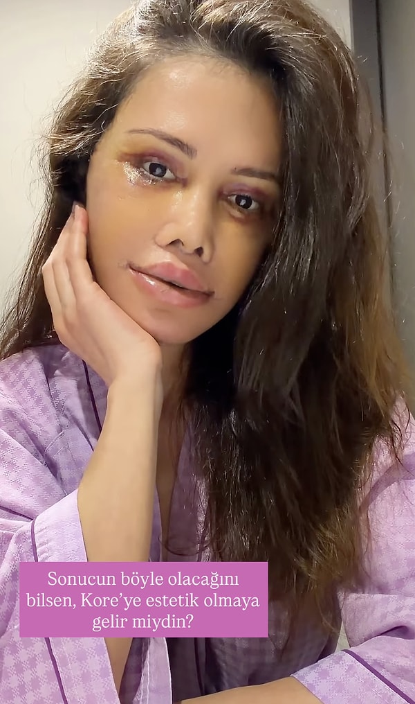 Bir süredir ekranlardan uzak olan Ceran, son günlerde bambaşka bir konuyla konuşuluyor.