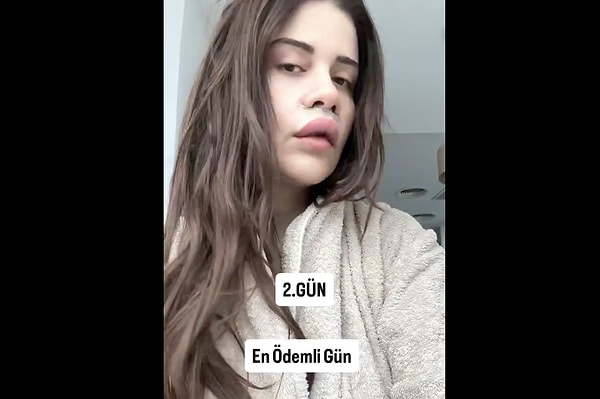 Peki nedir bu 'liplift'?