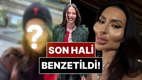 İlayda Oymak’ın Estetik Sonrası Değişimi Elmacık Kemikleriyle Tanınan Anastasia Pokreshchuk’a Benzetildi!