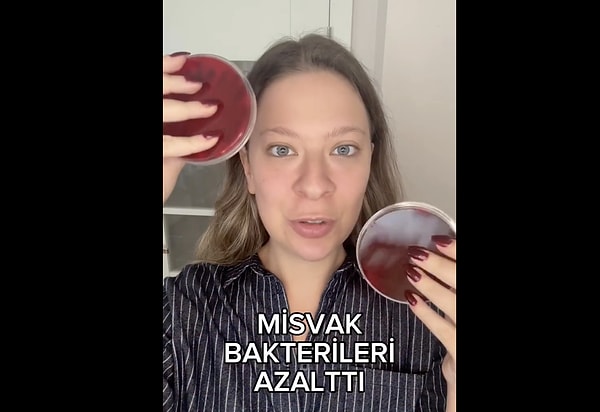 Diş hekimlerinin misvak ve diş macunu konusundaki  genel görüşleri şöyle;
