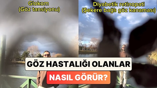 Bir Göz Doktoru Paylaştı: Farklı Göz Hastalıklarına Sahip Olan İnsanlar Nasıl Görür?