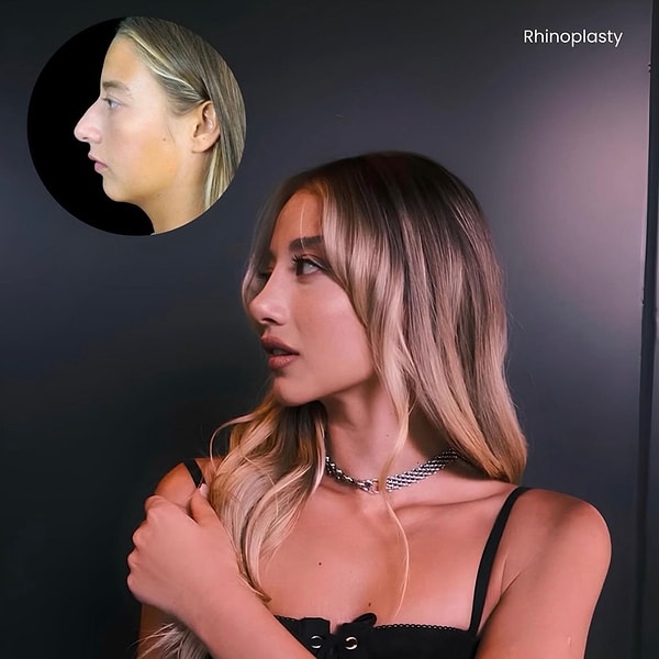 Geçtiğimiz saatlerde ise ne özel hayatıyla ne de müziğiyle gündeme oturdu. Bu sefer hamle, Aleyna Kalaycıoğlu'nun doktorundan geldi.