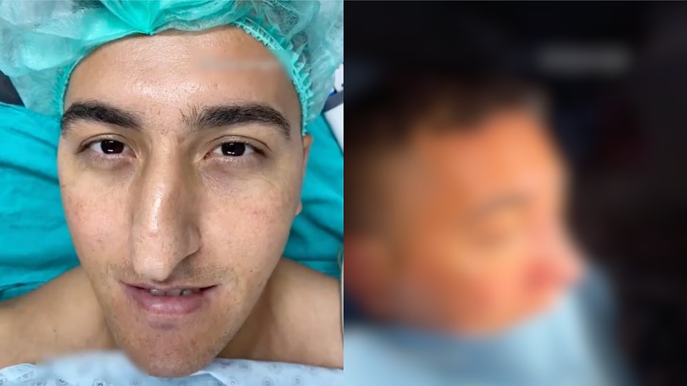 A Confidence-Boosting Journey: Surgeon Shares a Patient's Incredible Rhinoplasty Transformation That Inspires!