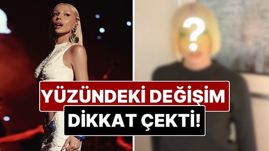 Şarkıcı Gülşen'in Yüzündeki Değişim Dikkat Çekti!