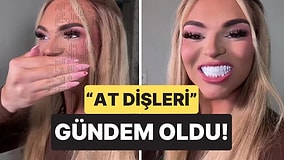 890 Bin TL Harcadı, Yaptırdığı Dişler Sosyal Medyada Alay Konusu Oldu