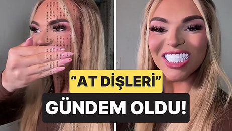 890 Bin TL Harcadı, Yaptırdığı Dişler Sosyal Medyada Alay Konusu Oldu