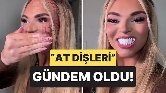 890 Bin TL Harcadı, Yaptırdığı Dişler Sosyal Medyada Alay Konusu Oldu