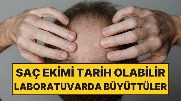 Saç Ekimi Tarih Olabilir! Bilim İnsanları Laboratuvarda Saç Kökü Büyüttü