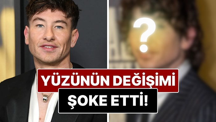 Oyuncu Barry Keohgan'ın Yüzündeki Değişim Görenleri Şaşırttı!
