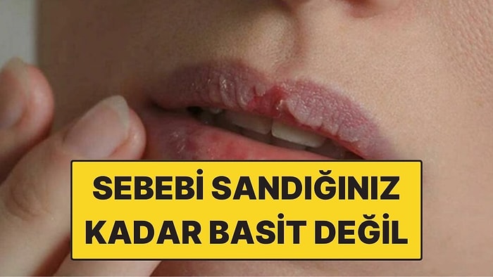 Psikolojiye Göre Dudak Yeme Alışkanlığı Ne Anlama Geliyor?