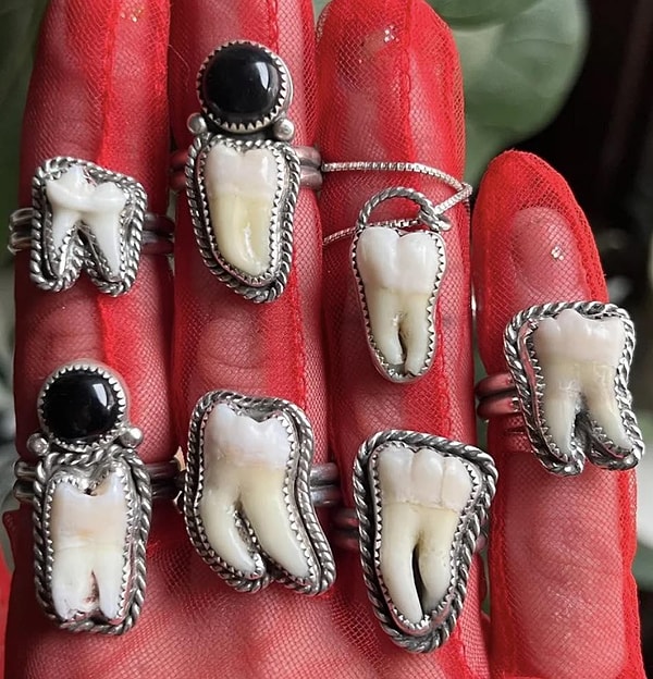 8. "Dişini tırnağına takmak" dedikleri bu olsa gerek!