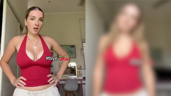 Weight Off My Shoulders! Sharing My Honest Journey And The Amazing Change After Breast Reduction Surgery