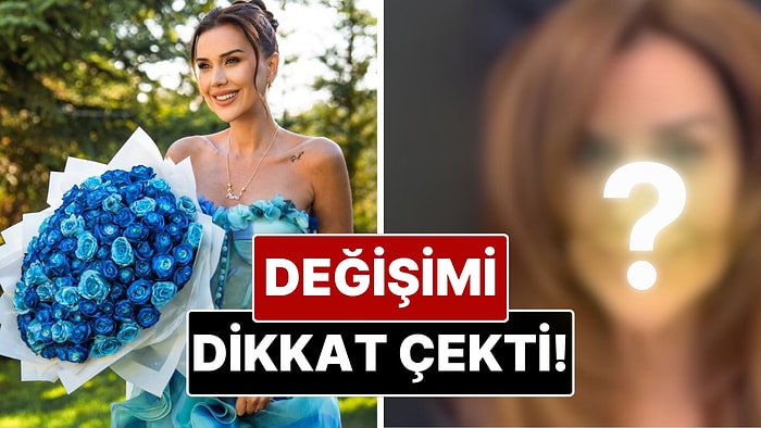 Dilan Polat’ın Son Hali Gündem Oldu: Değişimi Dikkat Çekti!