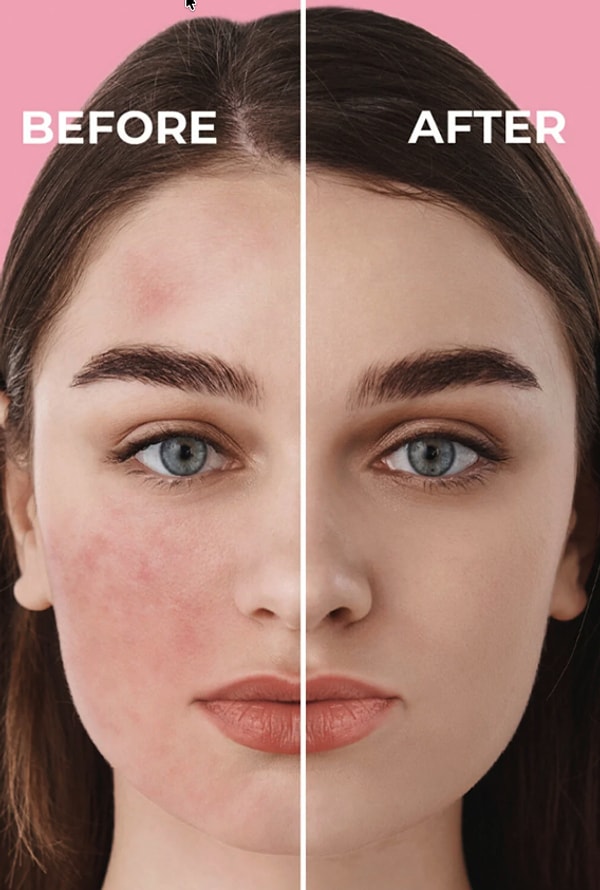 Anında Ton Eşitleyici Leke Karşıtı Sinoz Pink Touch