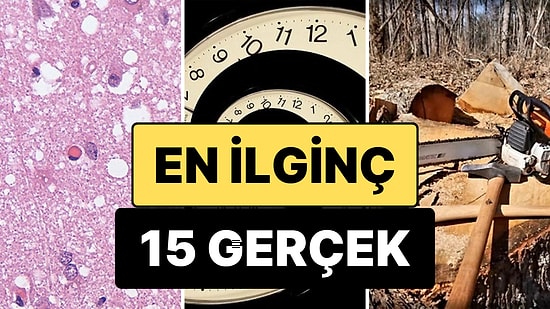 Öğrendikten Sonra Aklınızdan Silmek İsteyeceğiniz En Ürpertici 15 Gerçek