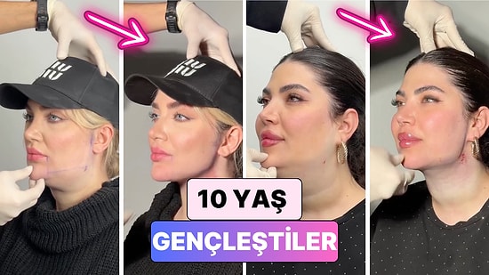 Gıdı Operasyonu ile Bilinen Bir Doktor Hastalarının Yaşadığı Değişimi Paylaştı