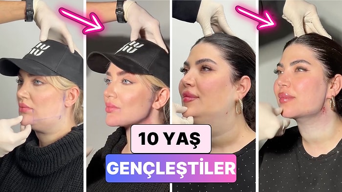 Gıdı Operasyonu ile Bilinen Bir Doktor Hastalarının Yaşadığı Değişimi Paylaştı